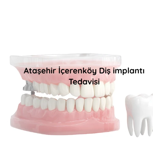 Ataşehir İçerenköy Diş İmplantı