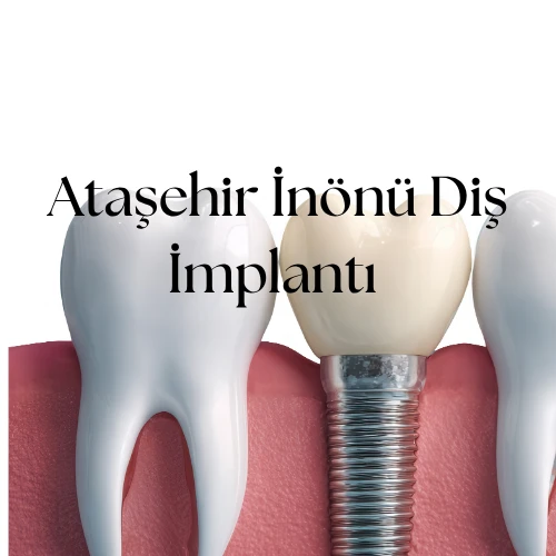 Ataşehir İnönü Diş İmplantı