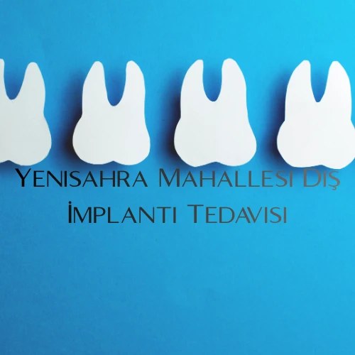 Yenisahra Mahallesi Diş İmplantı Tedavisi